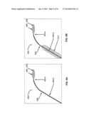 CATHETER DEVICE INCLUDING FLOW SENSING diagram and image