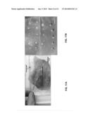 CATHETER DEVICE INCLUDING FLOW SENSING diagram and image