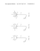 CYROGENIC TREATMENT METHODS diagram and image