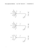 CYROGENIC TREATMENT METHODS diagram and image