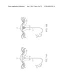 CYROGENIC TREATMENT METHODS diagram and image