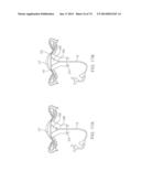 CYROGENIC TREATMENT METHODS diagram and image