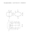 CYROGENIC TREATMENT METHODS diagram and image