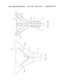 CYROGENIC TREATMENT METHODS diagram and image