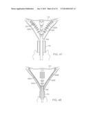 CYROGENIC TREATMENT METHODS diagram and image