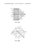 CYROGENIC TREATMENT METHODS diagram and image