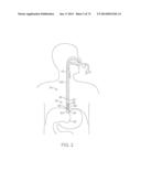 TIME-LIMITED METHODS FOR CYROGENIC TREATMENT SYSTEMS diagram and image