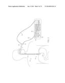 TIME-LIMITED METHODS FOR CYROGENIC TREATMENT SYSTEMS diagram and image