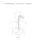 TIME-LIMITED METHODS FOR CYROGENIC TREATMENT SYSTEMS diagram and image