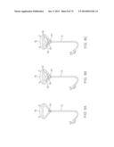 TIME-LIMITED METHODS FOR CYROGENIC TREATMENT SYSTEMS diagram and image