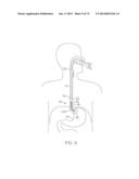 TIME-LIMITED METHODS FOR CYROGENIC TREATMENT SYSTEMS diagram and image