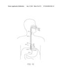 TIME-LIMITED METHODS FOR CYROGENIC TREATMENT SYSTEMS diagram and image