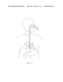 TIME-LIMITED METHODS FOR CYROGENIC TREATMENT SYSTEMS diagram and image