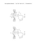 TIME-LIMITED METHODS FOR CYROGENIC TREATMENT SYSTEMS diagram and image