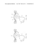 TIME-LIMITED METHODS FOR CYROGENIC TREATMENT SYSTEMS diagram and image