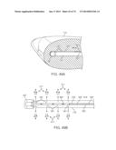 TIME-LIMITED METHODS FOR CYROGENIC TREATMENT SYSTEMS diagram and image