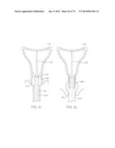 TIME-LIMITED METHODS FOR CYROGENIC TREATMENT SYSTEMS diagram and image