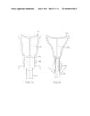 TIME-LIMITED METHODS FOR CYROGENIC TREATMENT SYSTEMS diagram and image