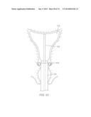 TIME-LIMITED METHODS FOR CYROGENIC TREATMENT SYSTEMS diagram and image