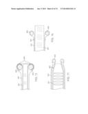 TIME-LIMITED METHODS FOR CYROGENIC TREATMENT SYSTEMS diagram and image