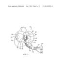 CARDIAC TREATMENT DEVICES AND METHODS diagram and image