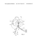 CARDIAC TREATMENT DEVICES AND METHODS diagram and image