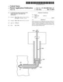 Ultrasound Enhanced Selective Tissue Removal Method and Apparatus diagram and image