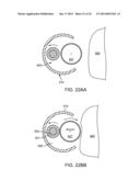 Ultrasound Enhanced Selective Tissue Removal Method and Apparatus diagram and image