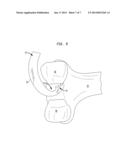 ORTHOPEDIC SAW BLADE diagram and image