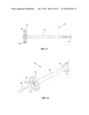 SYSTEM AND METHOD FOR JOINT RESURFACING AND REPAIR diagram and image