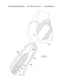 Tissue Repair Assembly diagram and image