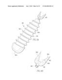 Tissue Repair Assembly diagram and image