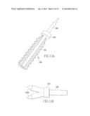 Tissue Repair Assembly diagram and image