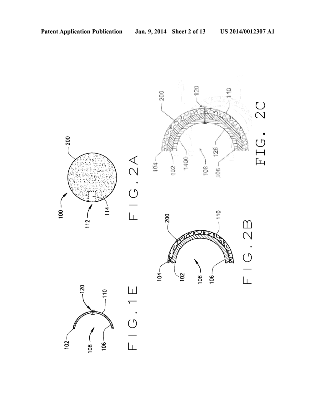 DETACHABLE METAL BALLOON DELIVERY DEVICE AND METHOD - diagram, schematic, and image 03