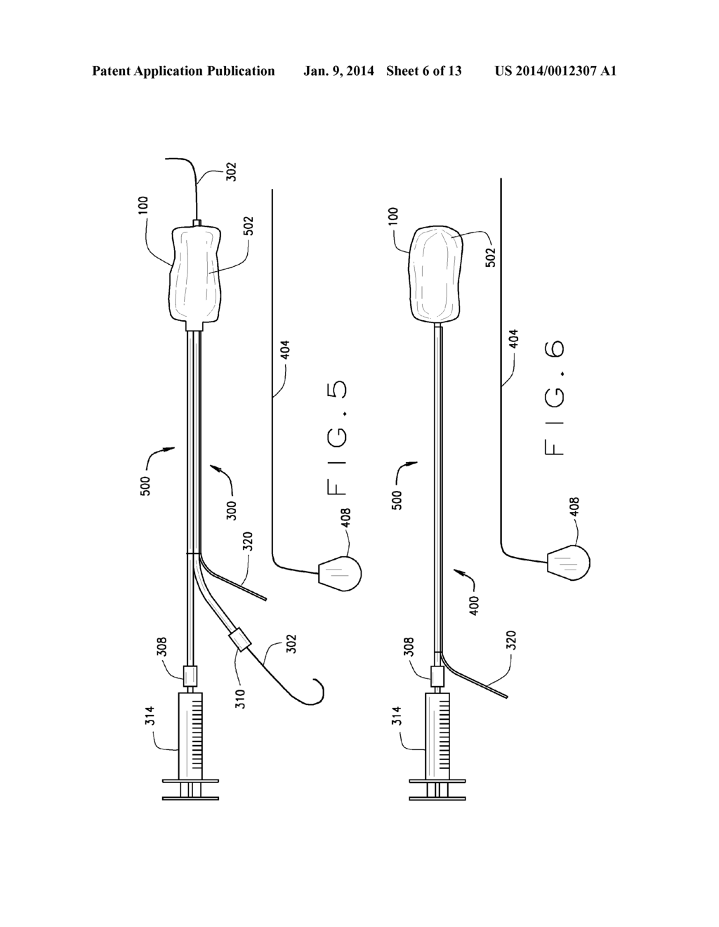 DETACHABLE METAL BALLOON DELIVERY DEVICE AND METHOD - diagram, schematic, and image 07