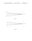 CUPPED FORCEPS diagram and image