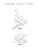 WOUND CLOSURE INVOLVING SILICONE diagram and image