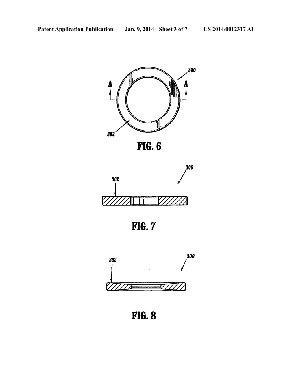 ANNULAR SUPPORT STRUCTURES - diagram, schematic, and image 04