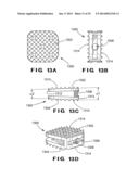 DEVICES AND METHOD FOR TREATMENT OF SPONDYLOTIC DISEASE diagram and image