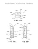 DEVICES AND METHOD FOR TREATMENT OF SPONDYLOTIC DISEASE diagram and image