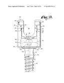 POLYAXIAL BONE SCREW WITH SHANK ARTICULATION PRESSURE INSERT AND METHOD diagram and image