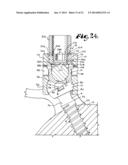 POLYAXIAL BONE SCREW WITH SHANK ARTICULATION PRESSURE INSERT AND METHOD diagram and image