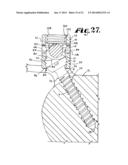 POLYAXIAL BONE SCREW WITH SHANK ARTICULATION PRESSURE INSERT AND METHOD diagram and image