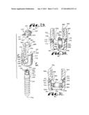 POLYAXIAL BONE SCREW WITH SHANK ARTICULATION PRESSURE INSERT AND METHOD diagram and image