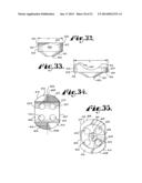 POLYAXIAL BONE SCREW WITH SHANK ARTICULATION PRESSURE INSERT AND METHOD diagram and image