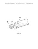 Methods of Stabilizing the Sacroiliac Joint diagram and image