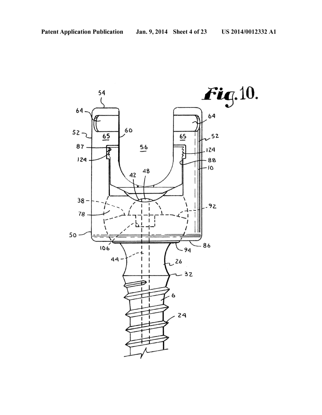 POLYAXIAL BONE SCREW WITH SHANK ARTICULATION PRESSURE INSERT AND METHOD - diagram, schematic, and image 05