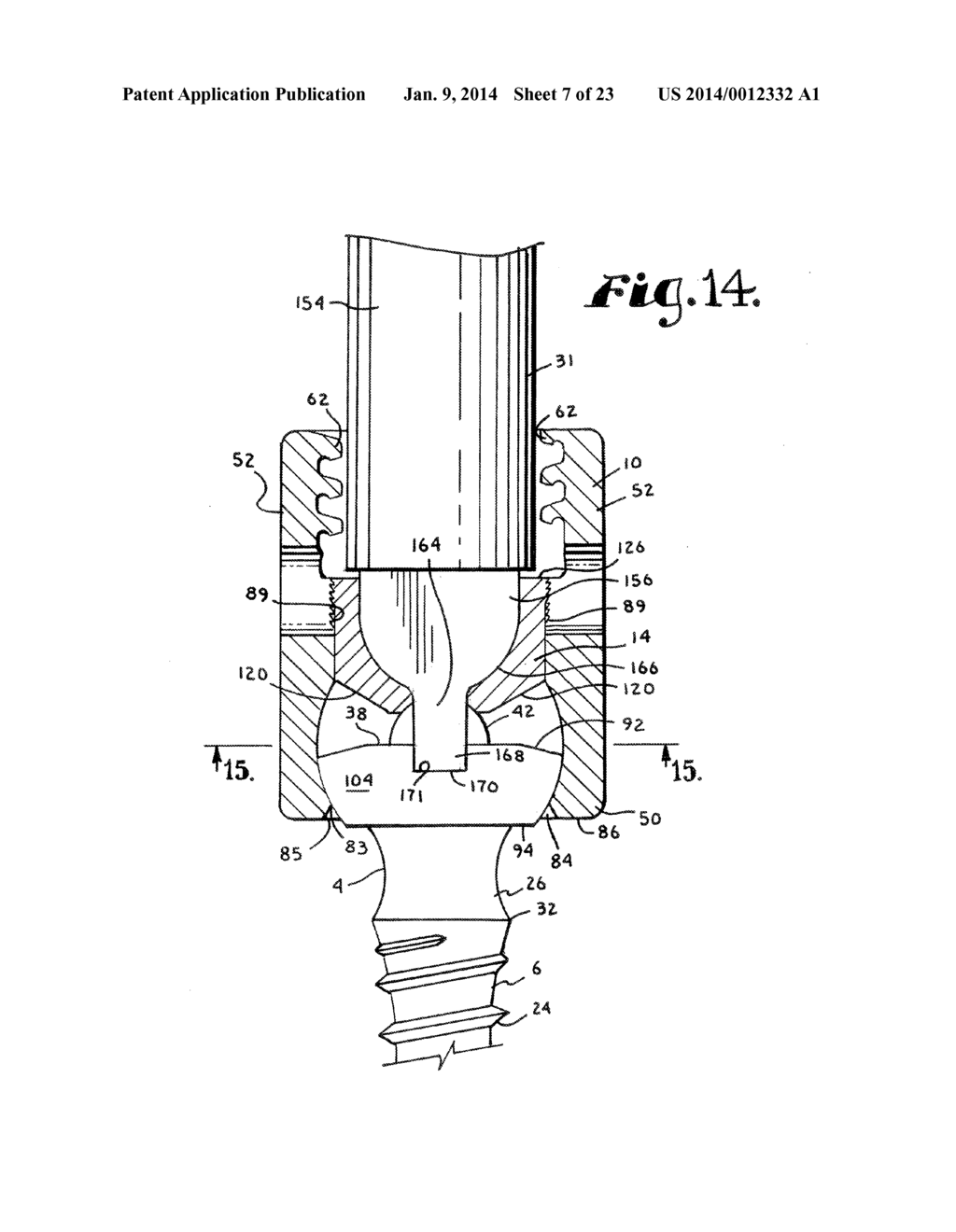 POLYAXIAL BONE SCREW WITH SHANK ARTICULATION PRESSURE INSERT AND METHOD - diagram, schematic, and image 08