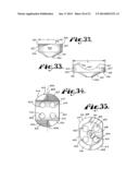 POLYAXIAL BONE SCREW WITH SHANK ARTICULATION PRESSURE INSERT AND METHOD diagram and image