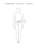 Light Therapy for Increasing CD34+ Cell Count in Peripheral Blood diagram and image